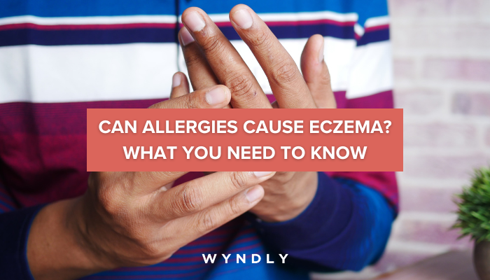 Allergic Eczema: Causes, Symptoms, And Treatment (2024) & Wyndly