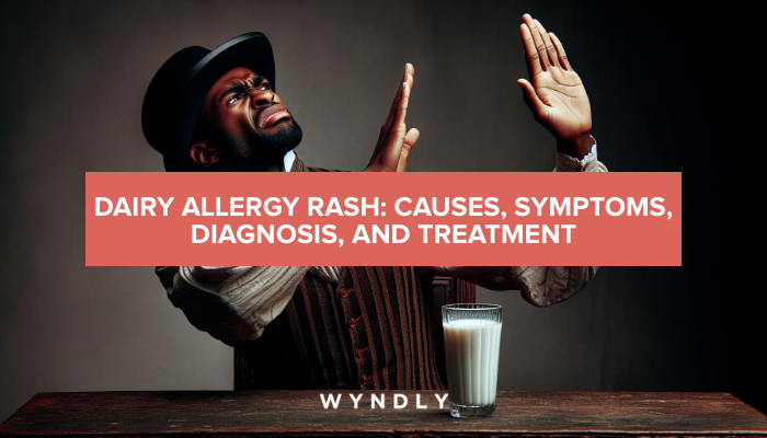 Dairy Allergy Rash Causes Symptoms And Treatment Guide 2024 And Wyndly 6076