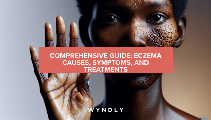 Eczema Uncovered: Causes, Symptoms, and Effective Treatments (2024 ...